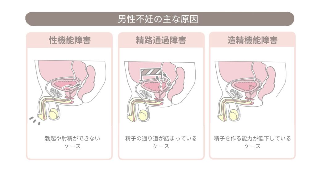 男性不妊の原因とは?精子疾患・生活習慣など主な原因を解説