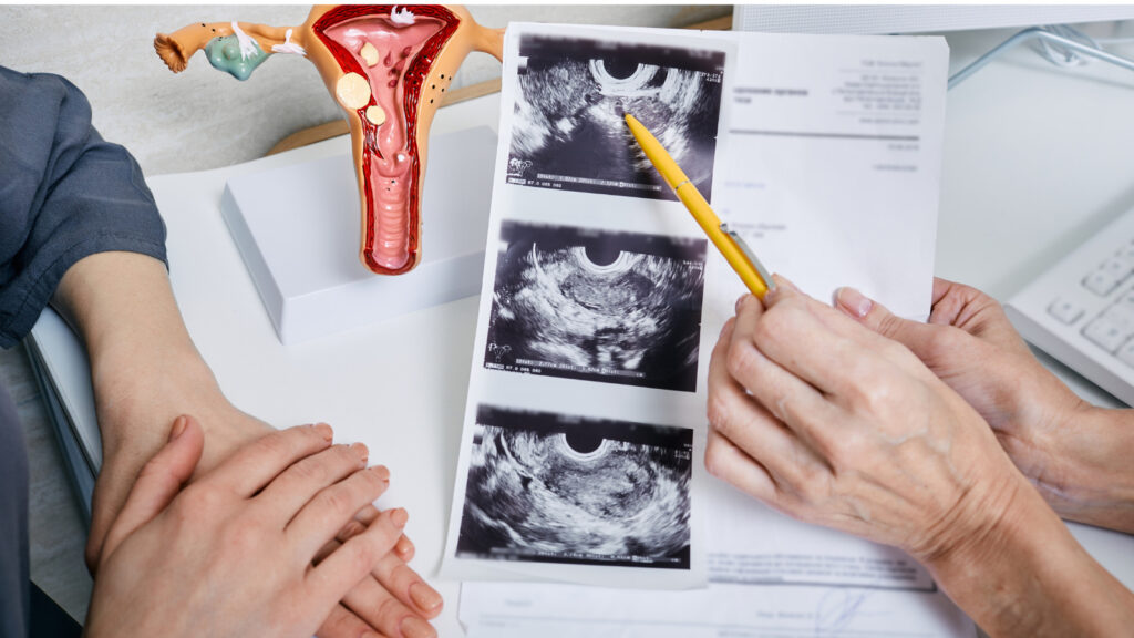 クラミジア既往と卵管の通り ─ 再評価のポイントと次の治療